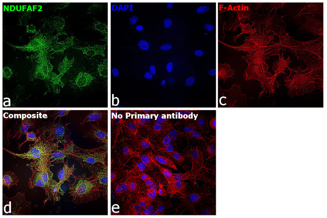 NDUFAF2 Antibody in Immunocytochemistry (ICC/IF)