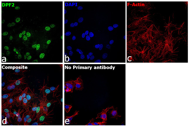 DPF2 Antibody in Immunocytochemistry (ICC/IF)