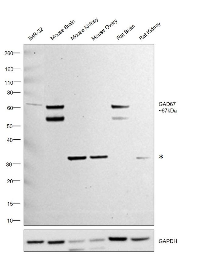 GAD67 Antibody in Western Blot (WB)