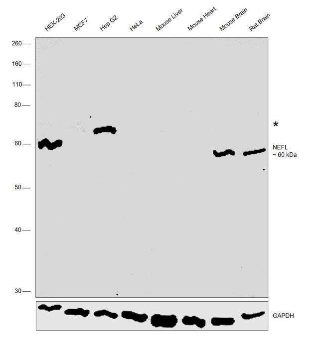 NEFL Antibody in Western Blot (WB)
