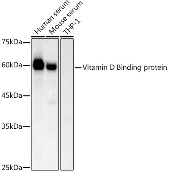 DBP Antibody in Western Blot (WB)