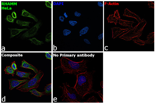 RHAMM Antibody in Immunocytochemistry (ICC/IF)