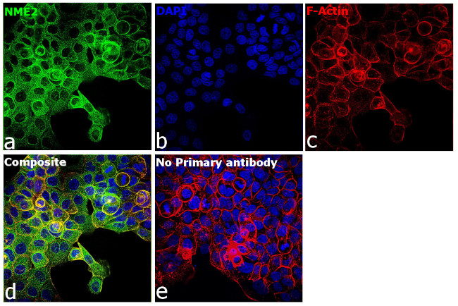 NME1/NME2 Antibody in Immunocytochemistry (ICC/IF)