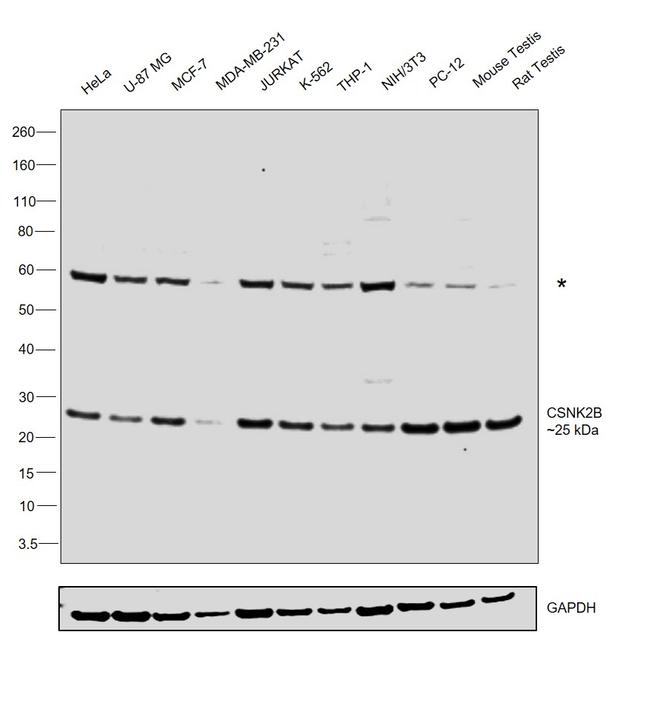 CK2 beta Antibody in Western Blot (WB)
