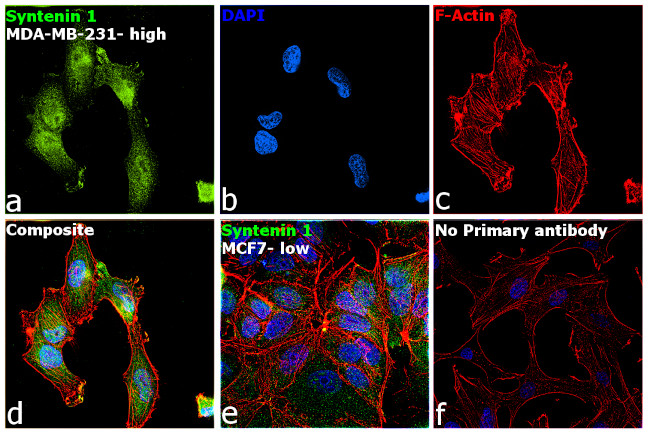 Syntenin 1 Antibody in Immunocytochemistry (ICC/IF)