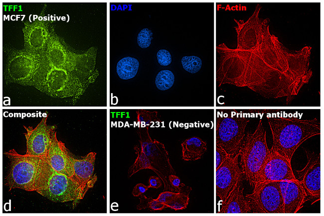 TFF1 Antibody in Immunocytochemistry (ICC/IF)