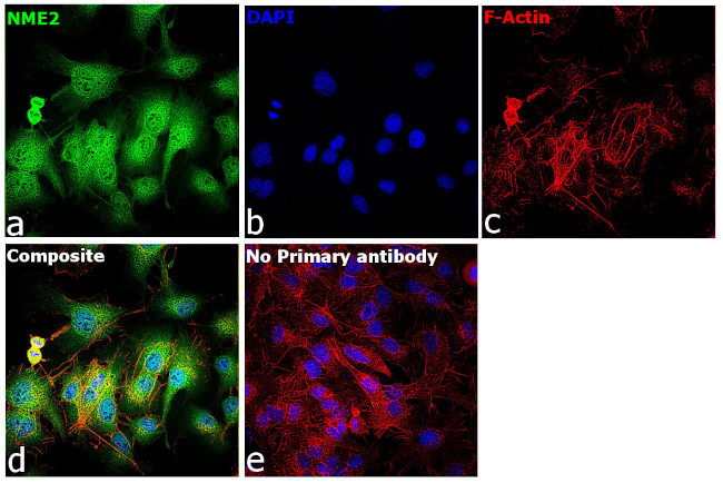 NME2 Antibody in Immunocytochemistry (ICC/IF)