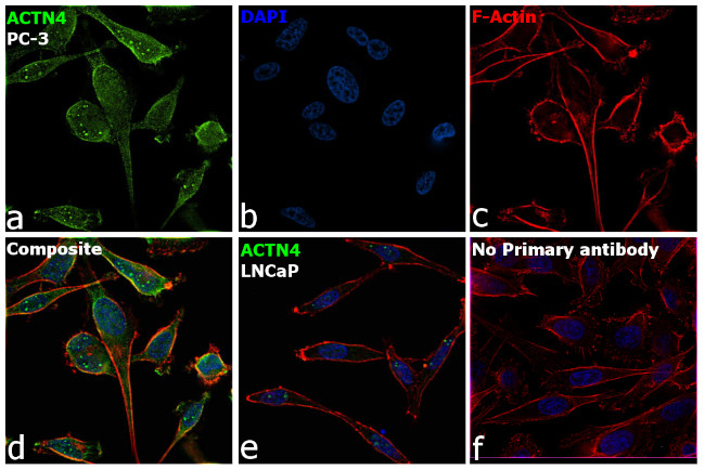 eIF3d Antibody in Immunocytochemistry (ICC/IF)