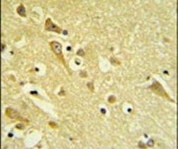 PAAF1 Antibody in Immunohistochemistry (IHC)