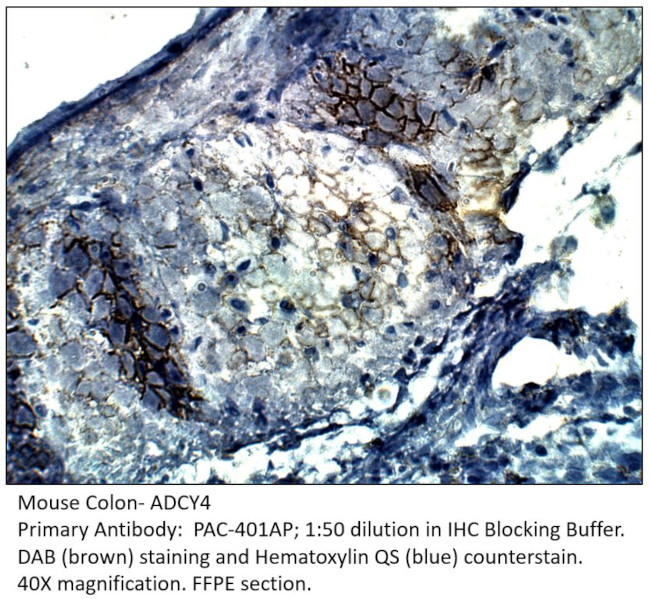 ADCY4 Antibody in Immunohistochemistry (IHC)