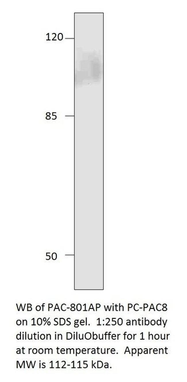 ADCY8 Antibody in Western Blot (WB)
