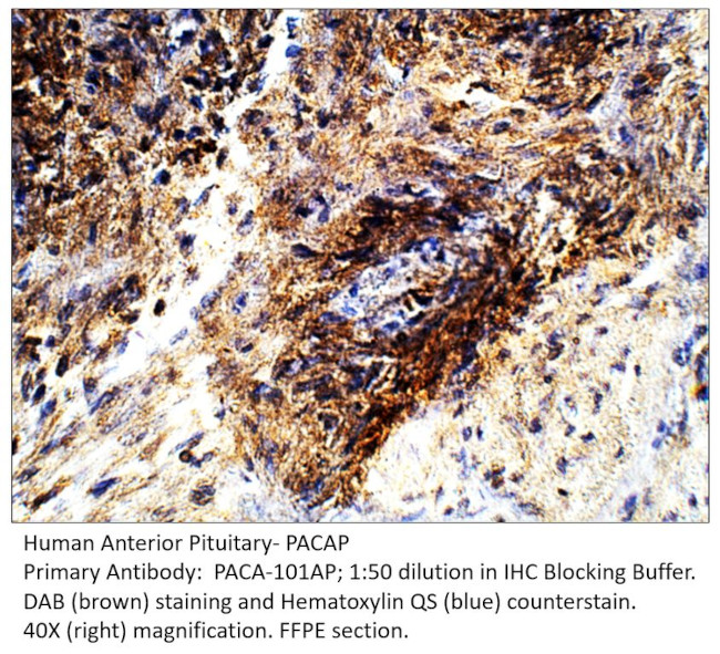 PACAP Antibody in Immunohistochemistry (IHC)