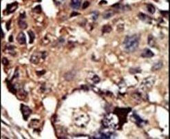 PACSIN1 Antibody in Immunohistochemistry (IHC)