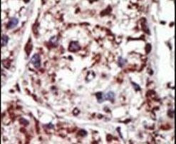 PACSIN1 Antibody in Immunohistochemistry (IHC)