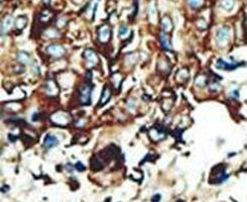 PACSIN2 Antibody in Immunohistochemistry (IHC)