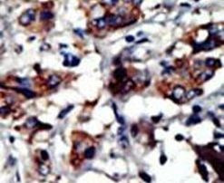 PACSIN3 Antibody in Immunohistochemistry (IHC)