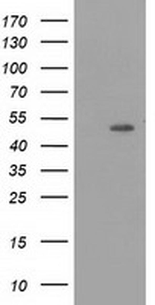 PACSIN3 Antibody in Western Blot (WB)