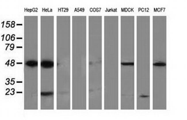 PACSIN3 Antibody in Western Blot (WB)