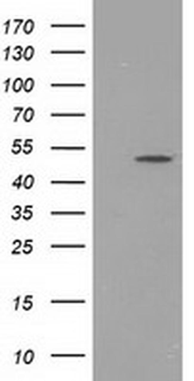 PACSIN3 Antibody in Western Blot (WB)