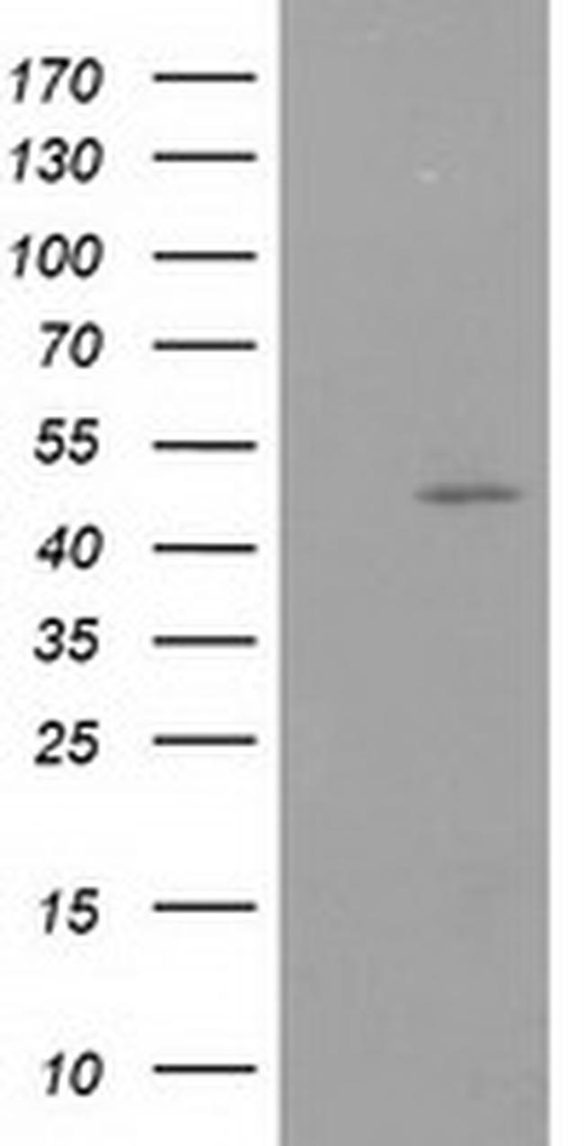 PACSIN3 Antibody in Western Blot (WB)
