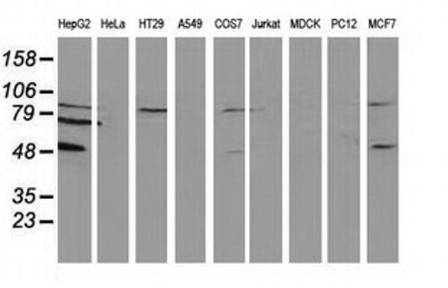 PACSIN3 Antibody in Western Blot (WB)