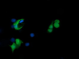 PADI4 Antibody in Immunocytochemistry (ICC/IF)