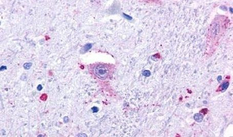 GPR37 Antibody in Immunohistochemistry (Paraffin) (IHC (P))