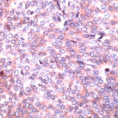 PAK2 Antibody in Immunohistochemistry (IHC)