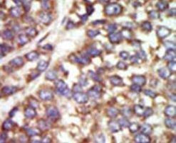 PAK2 Antibody in Immunohistochemistry (IHC)