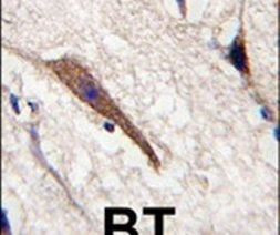 PAK7 Antibody in Immunohistochemistry (IHC)