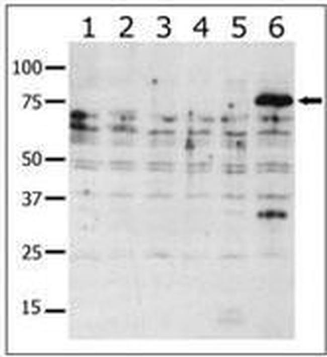 PAK6 Antibody in Western Blot (WB)