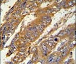PAN3 Antibody in Immunohistochemistry (IHC)