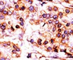 PANK1 Antibody in Immunohistochemistry (IHC)