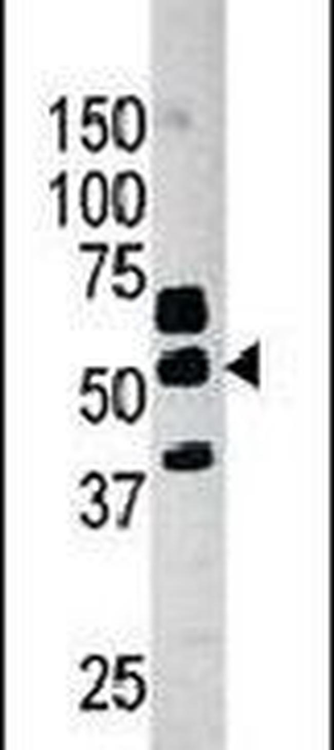 PANK2 Antibody in Western Blot (WB)