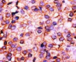 PANK3 Antibody in Immunohistochemistry (IHC)