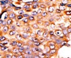 PANK3 Antibody in Immunohistochemistry (IHC)