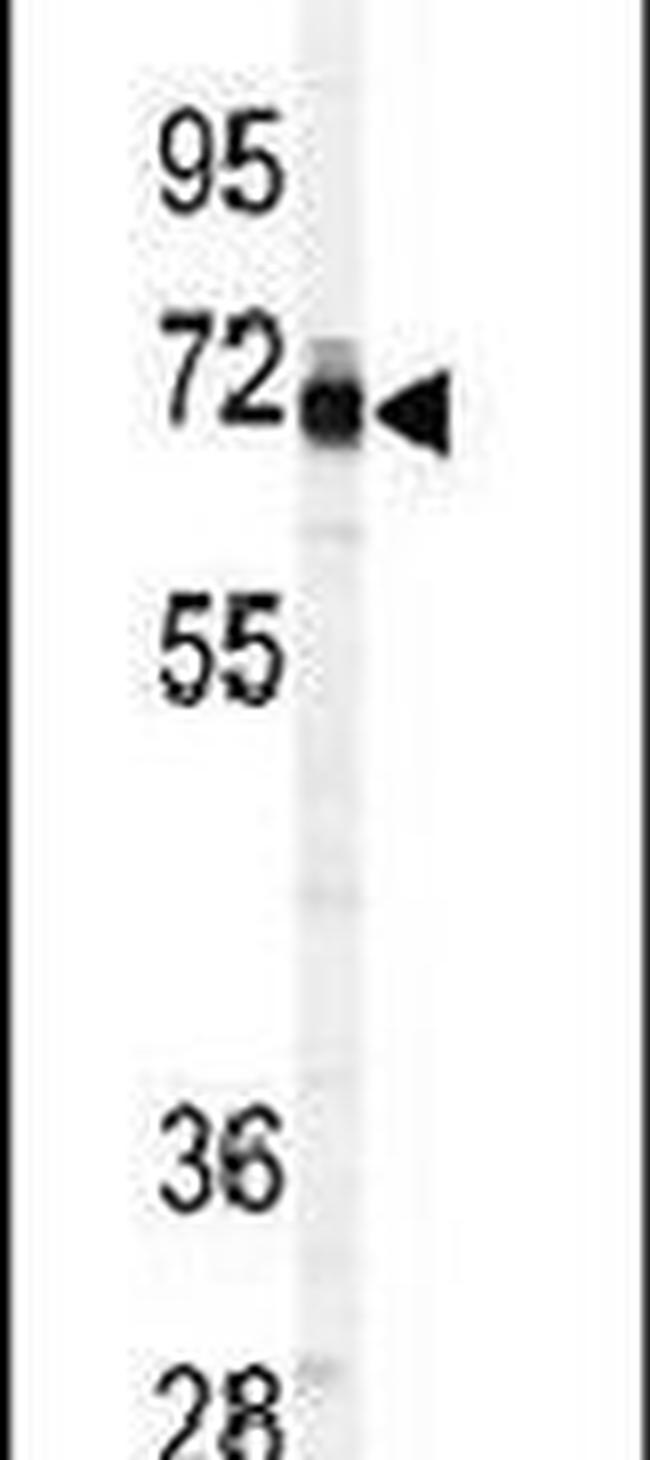 PAPSS1 Antibody in Western Blot (WB)