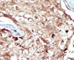 PAPSS2 Antibody in Immunohistochemistry (IHC)