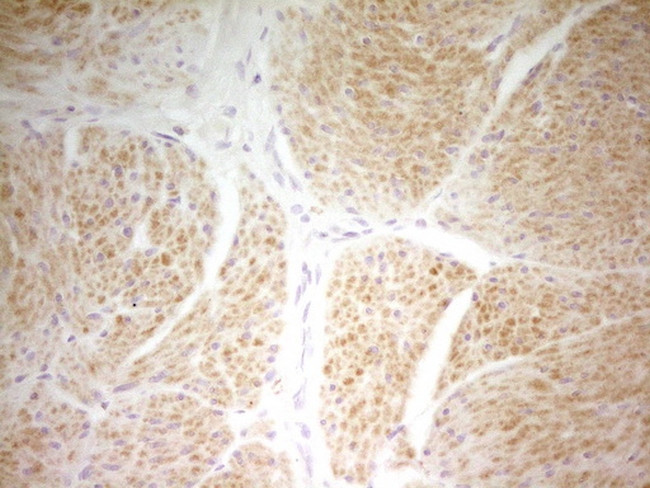 PAPSS2 Antibody in Immunohistochemistry (Paraffin) (IHC (P))