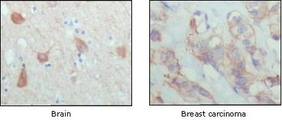 PAR4 Antibody in Immunohistochemistry (Paraffin) (IHC (P))