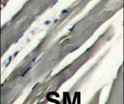 LRRK2 Antibody in Immunohistochemistry (IHC)
