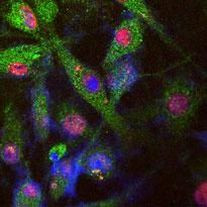 LRRK2 Antibody in Immunocytochemistry (ICC/IF)