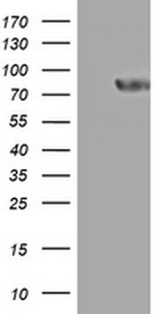 PARN Antibody in Western Blot (WB)