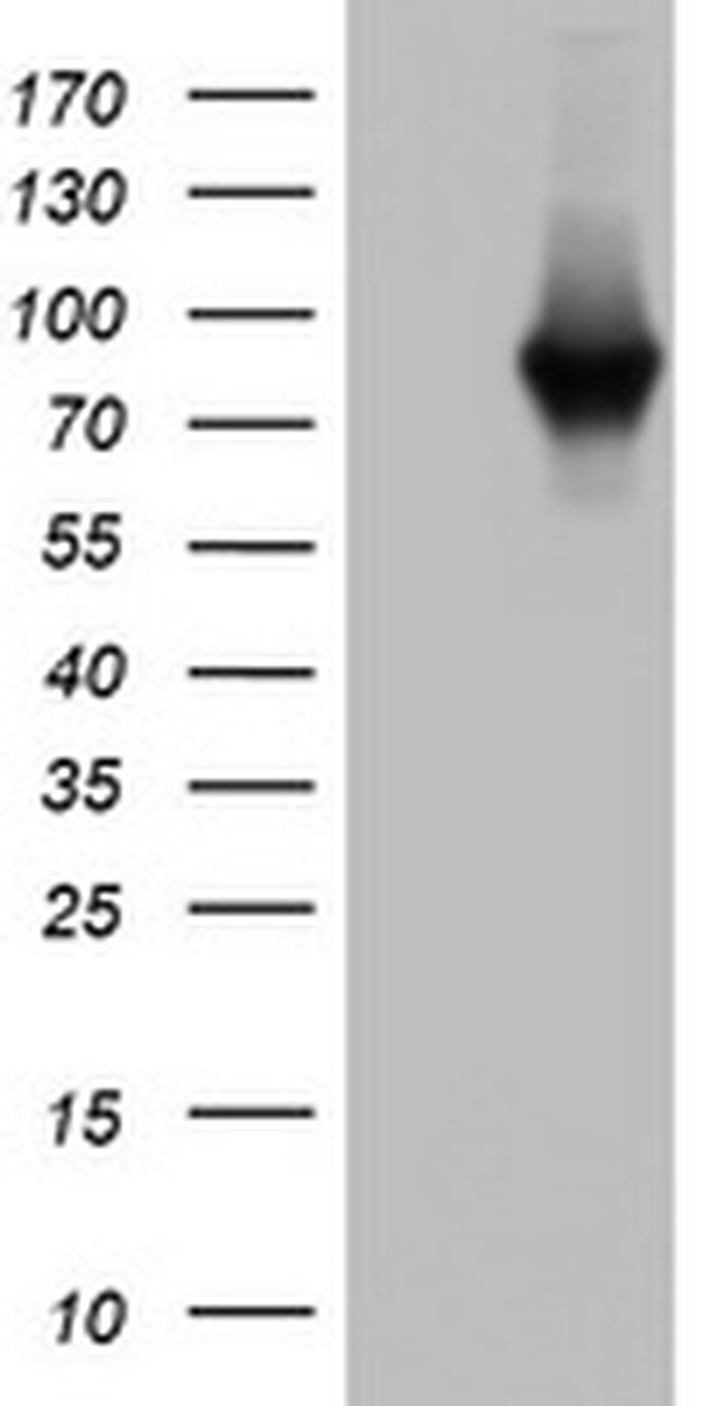 PARN Antibody in Western Blot (WB)