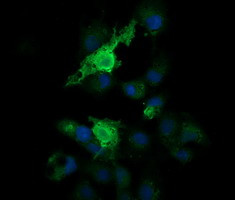 PARVA Antibody in Immunocytochemistry (ICC/IF)