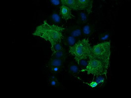 PARVA Antibody in Immunocytochemistry (ICC/IF)