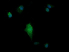 PARVA Antibody in Immunocytochemistry (ICC/IF)
