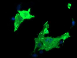 PARVA Antibody in Immunocytochemistry (ICC/IF)