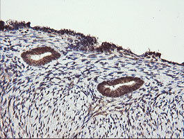 PARVA Antibody in Immunohistochemistry (Paraffin) (IHC (P))