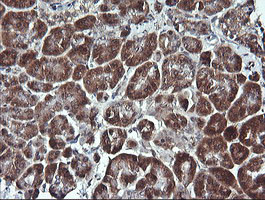 PARVA Antibody in Immunohistochemistry (Paraffin) (IHC (P))